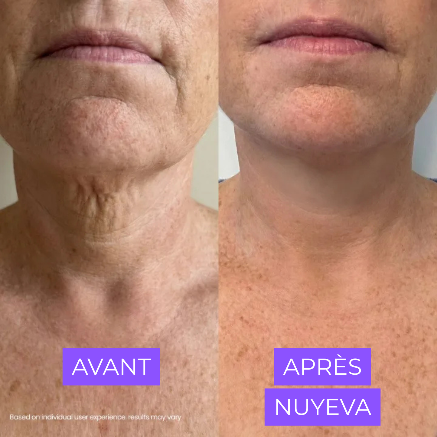 Crème Raffermissante Cou & Décolleté — Acide Hyaluronique & Beurre de Cupuaçu