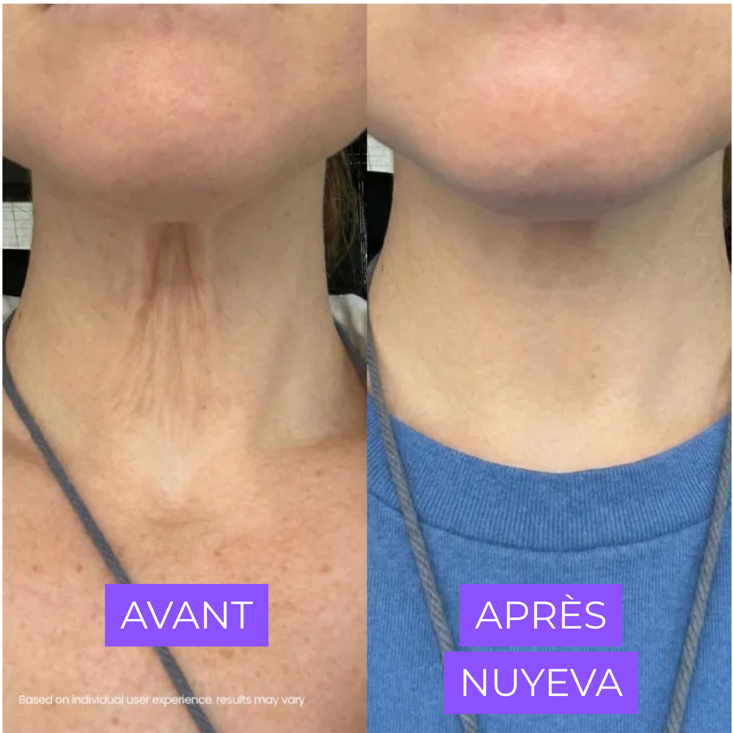 Crème Raffermissante Cou & Décolleté — Acide Hyaluronique & Beurre de Cupuaçu