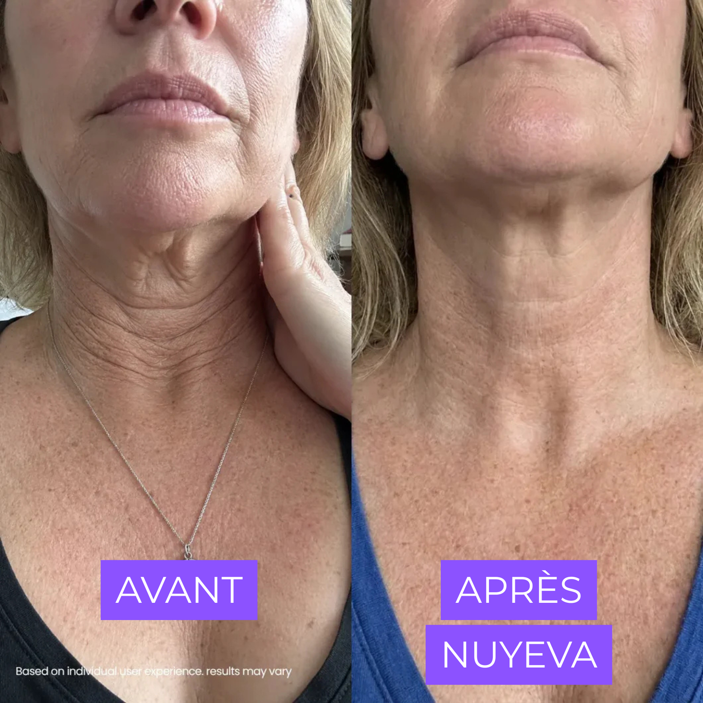 Crème Raffermissante Cou & Décolleté — Acide Hyaluronique & Beurre de Cupuaçu