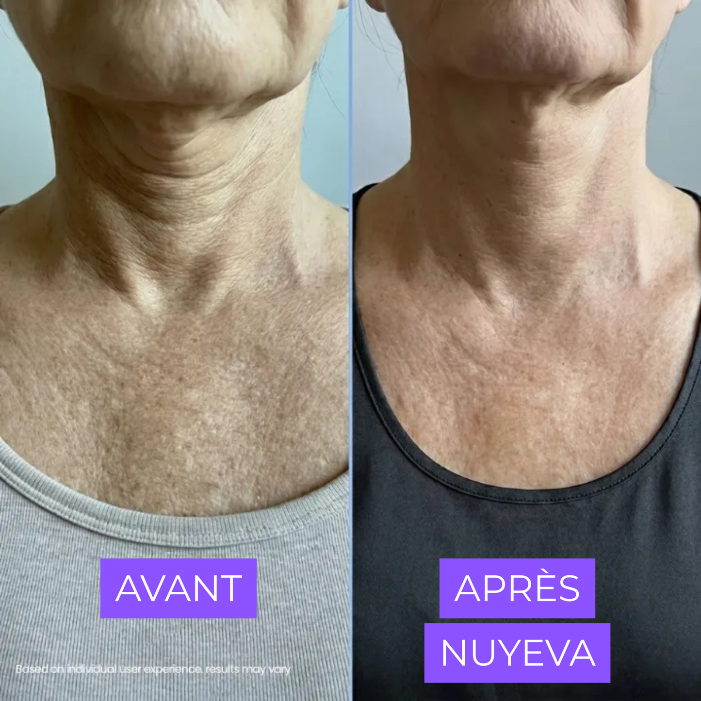 Crème Raffermissante Cou & Décolleté — Acide Hyaluronique & Beurre de Cupuaçu